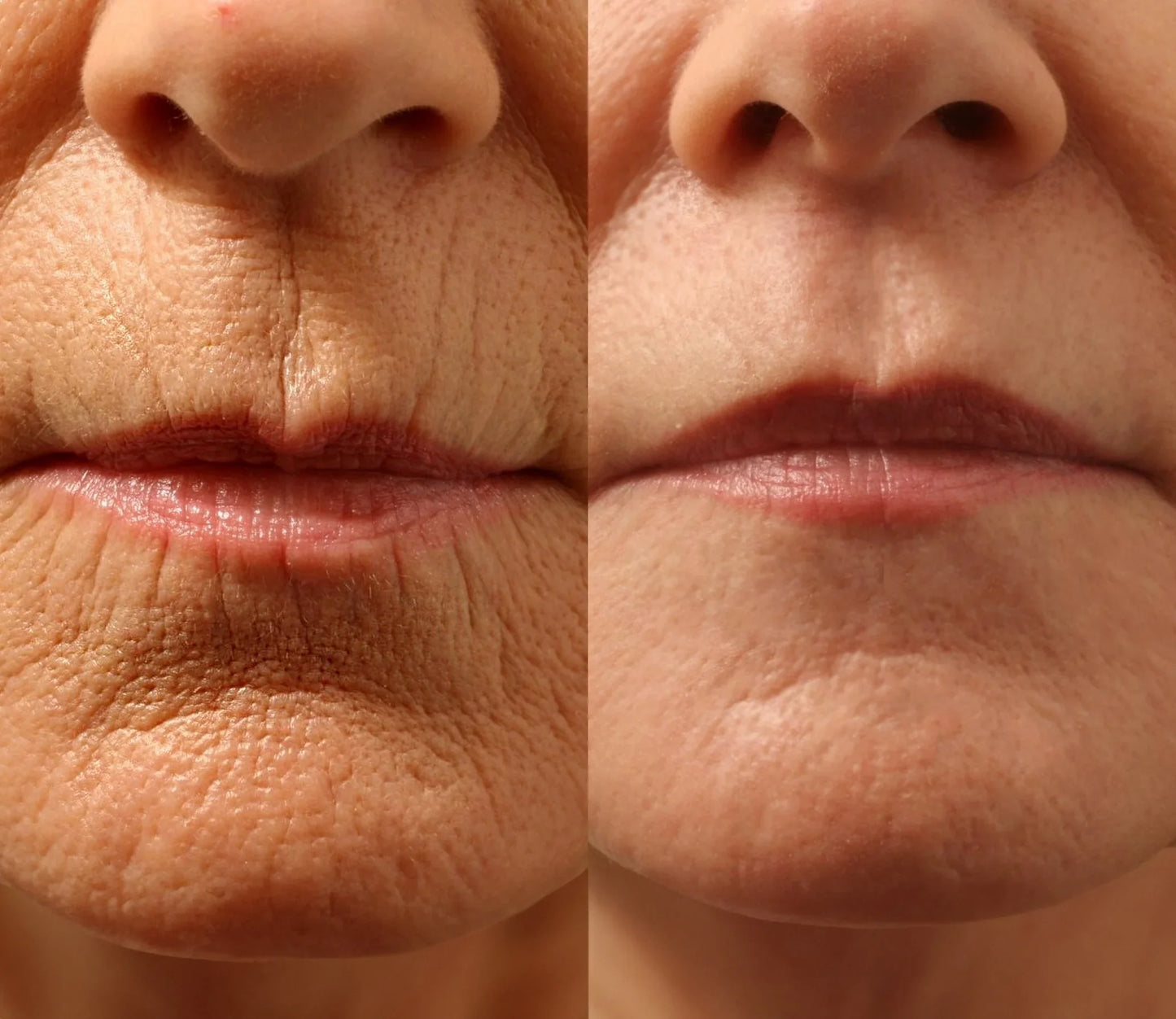 Natravor® Instant Wrinkle-Reducing Natural Cream