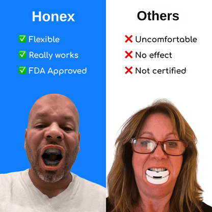 Honex™ - The Quiet Anti-Snoring Mouthpiece Universal Size