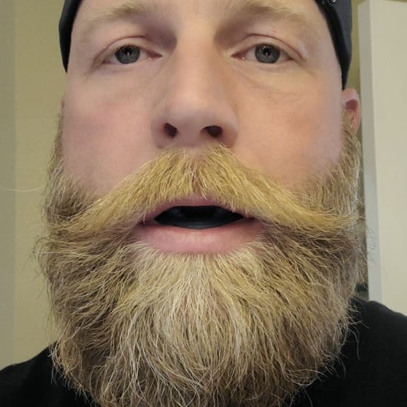 Honex™ - The Quiet Anti-Snoring Mouthpiece Universal Size